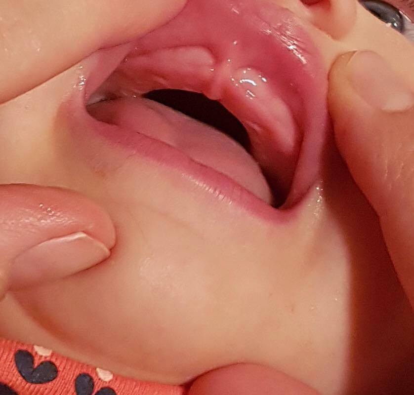 18342171_1315452638492170_7789203759494821304_n