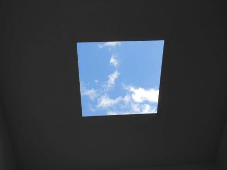 Tongue-Tie. A Modern Epidemic